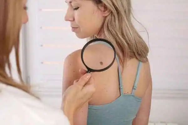 A side-by-side infographic comparing CryoPen cryotherapy with electrosurgery, highlighting differences in invasiveness, pain, and recovery Alton