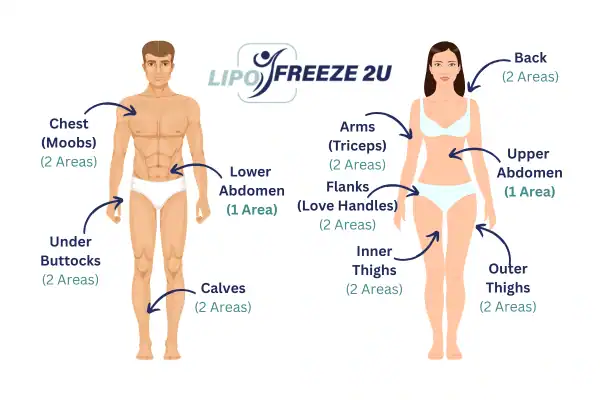 Areas you can have fat freezing treatment Alton