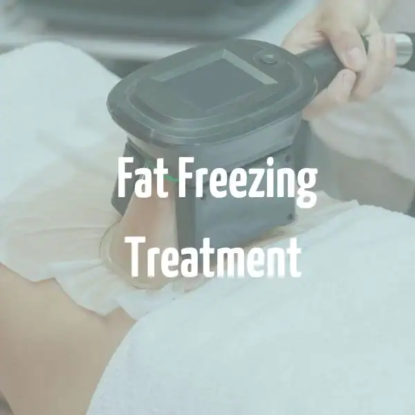 fat freezing treatment Alton