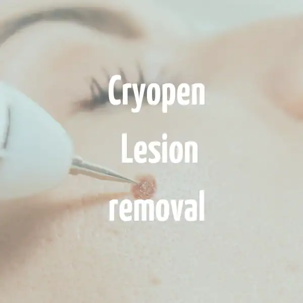 Who Is the Ideal Candidate for Each Method Alton?