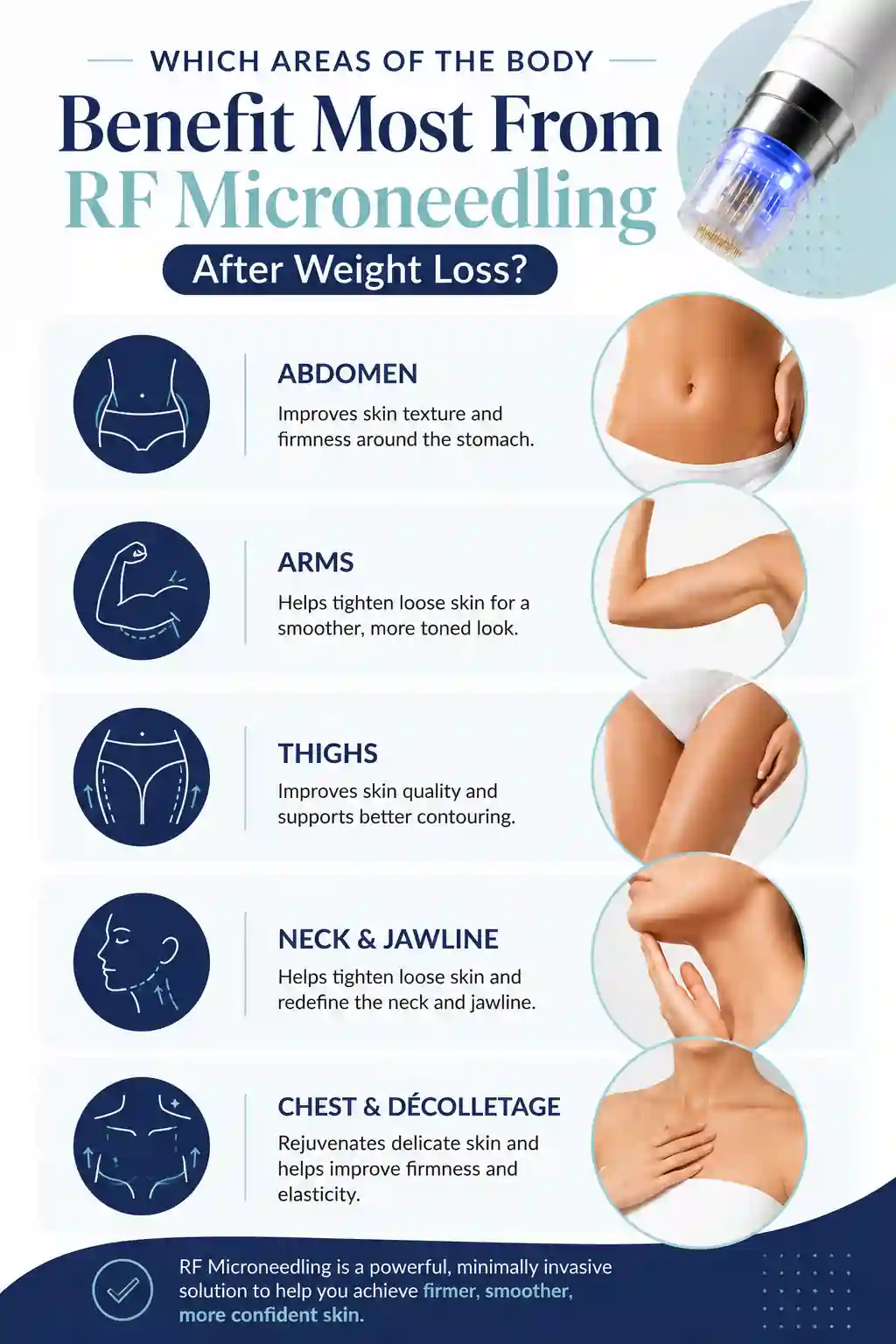 Which Areas of the Body Benefit Most From RF Microneedling After Weight Loss Alton